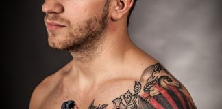 affidarsi a un professionista rimozione dei tatuaggi